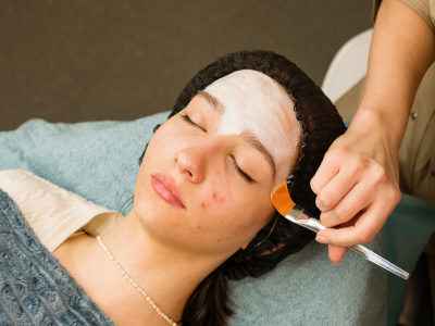 acne treatment in mumbai