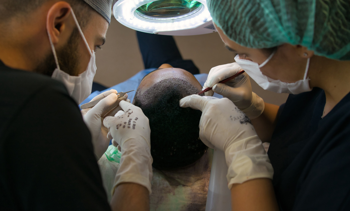 Hair transplant treatment in Santacruz,