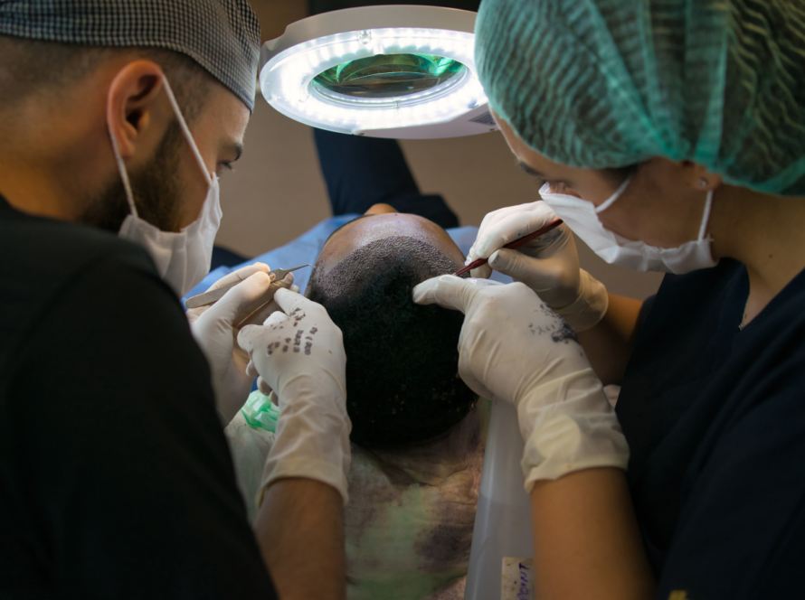 Hair transplant treatment in Santacruz,