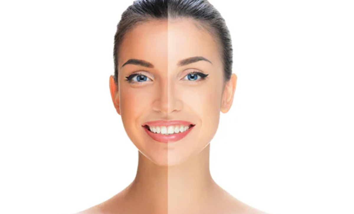 Suntan Treatment in Santacruz