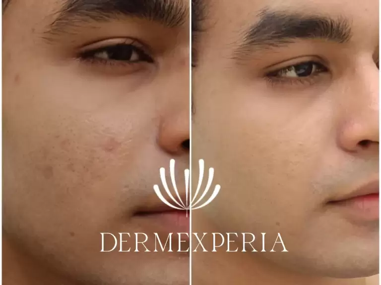 WhatsApp Image 2025-03-03 at 3.52.21 PM