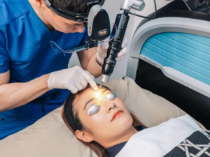 Picolaser Treatment in Santacruz