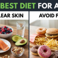 The Best Diet for Acne: What to Eat and Avoid for Clear Skin