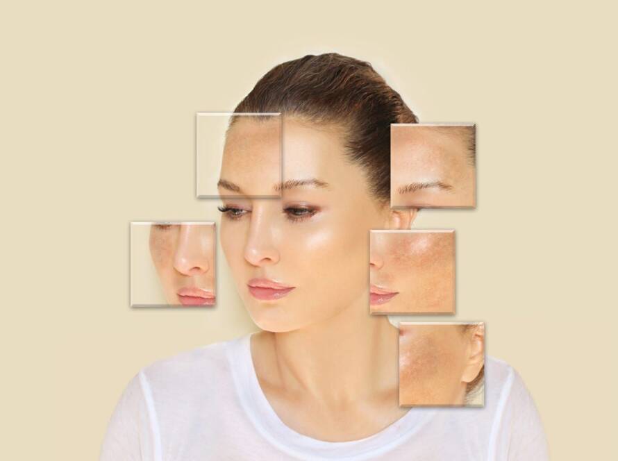 Skin Pigmentation Treatment in Mumbai