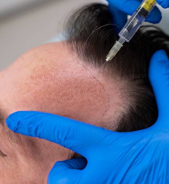 Best Hair Transplant Clinic in Mumbai