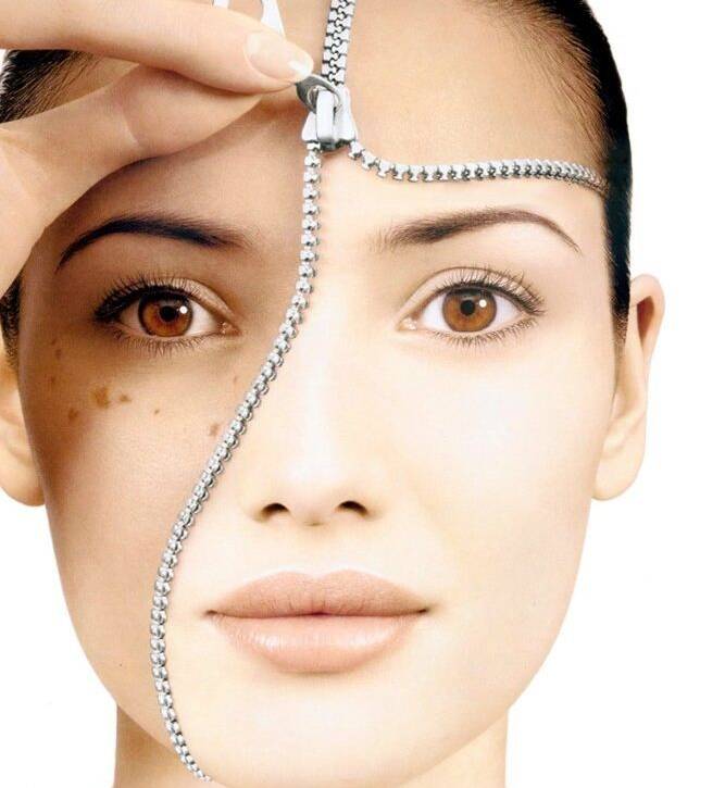 Best treatment for dark spots
