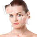 Who is the Best Dermatologist in Mumbai for Acne Treatment? (Complete Guide)