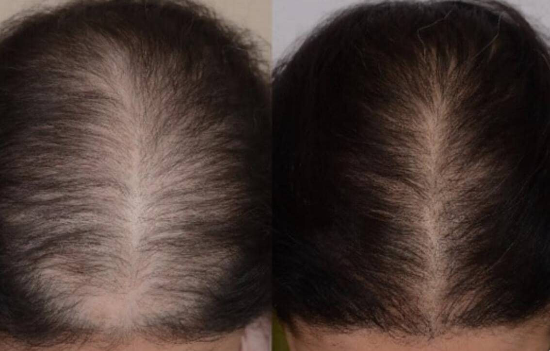 Hair Specialist Doctor