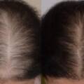 Hair Specialist Doctor in Mumbai – Expert Hair Care Solutions at Dermexperia