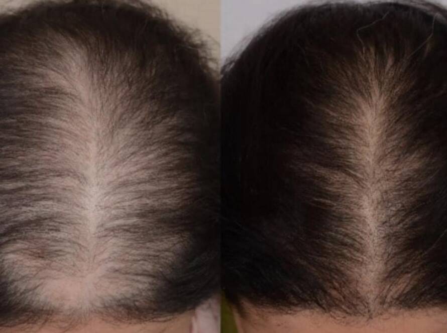 Hair Specialist Doctor