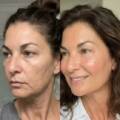 What Are Anti-Aging Treatments? Benefits, Options & What to Expect