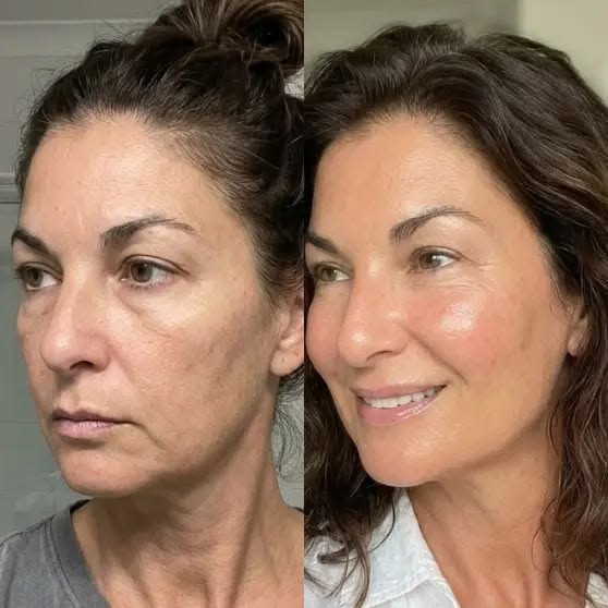 Anti-Aging Treatments in Mumbai